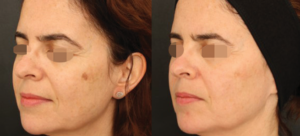 Screenshot 2025-08-04 132400