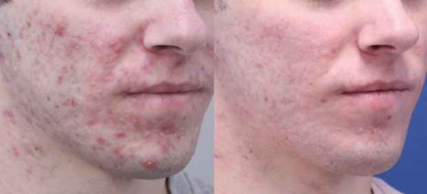 Screenshot 2025-08-04 134729