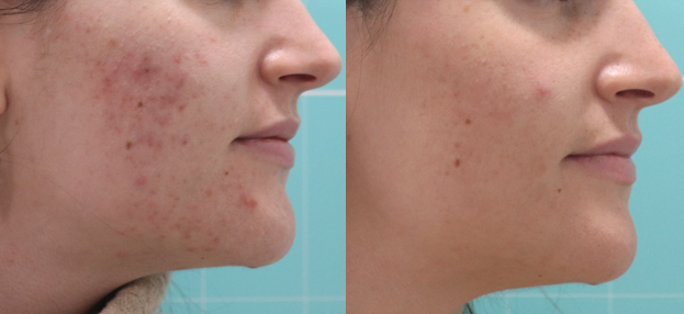 Screenshot 2025-08-04 134752