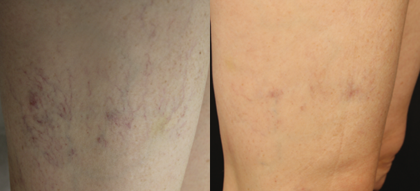 Screenshot 2025-08-29 130222