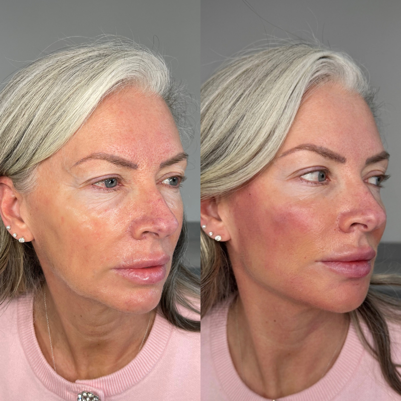 Untitled design (99)